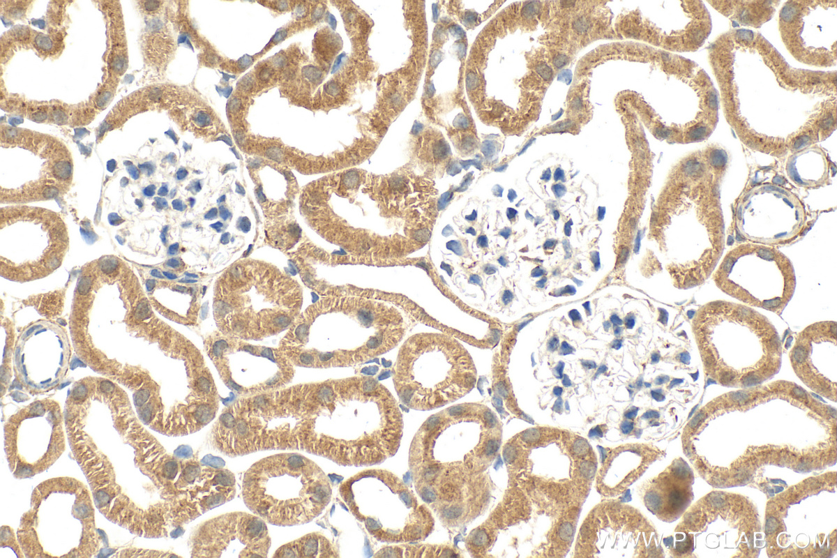 IHC staining of mouse kidney using 17650-1-AP