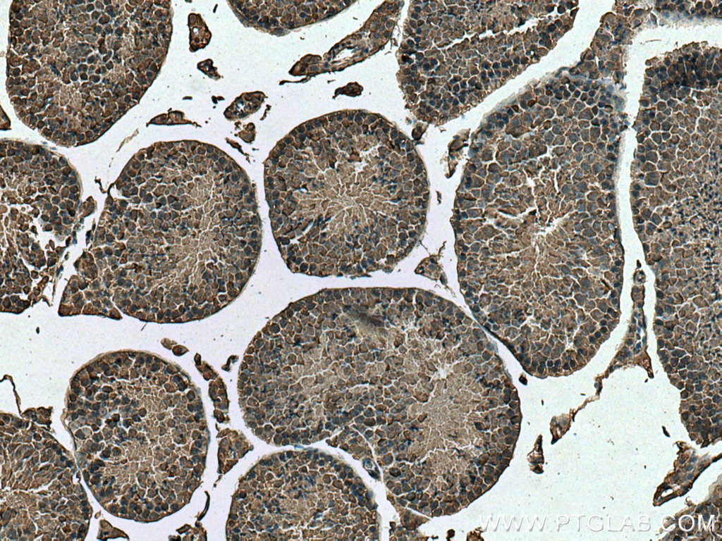 IHC staining of mouse testis using 66809-1-Ig