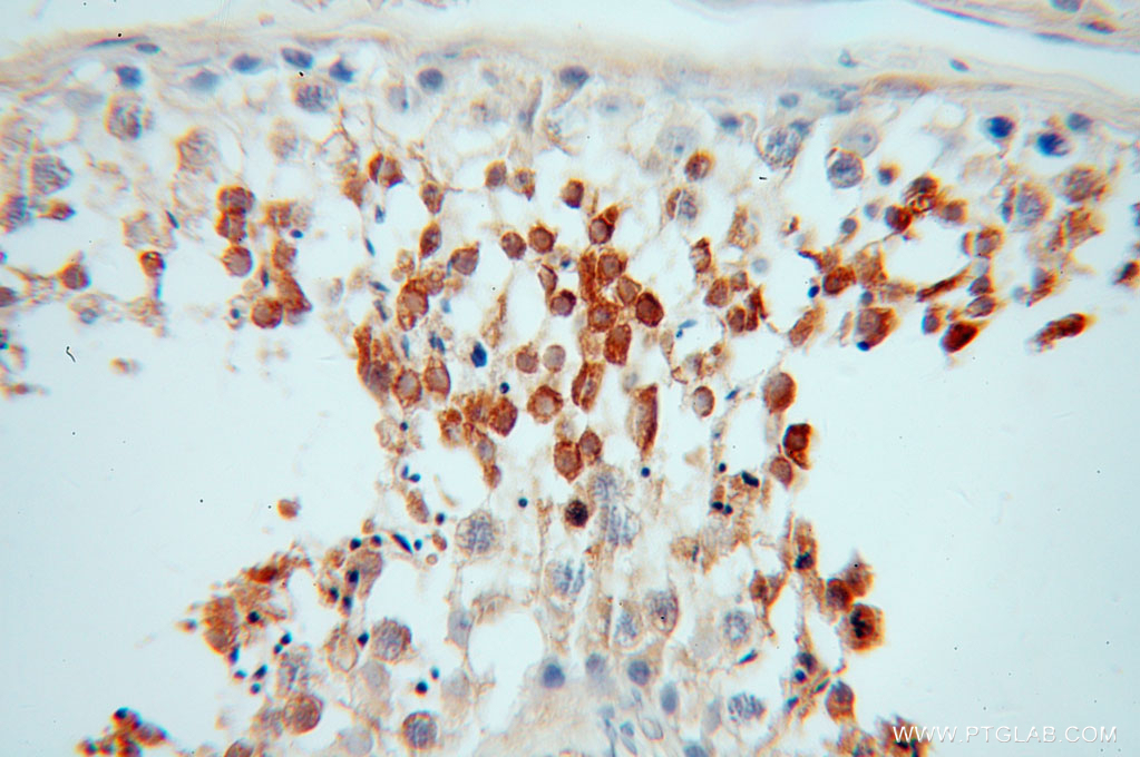 IHC staining of human testis using 12625-2-AP