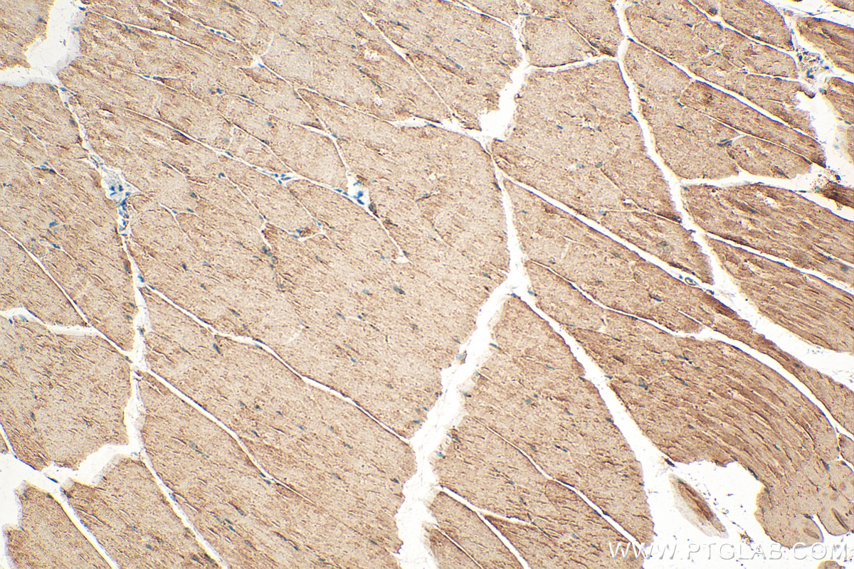 IHC staining of mouse skeletal muscle using 14960-1-AP