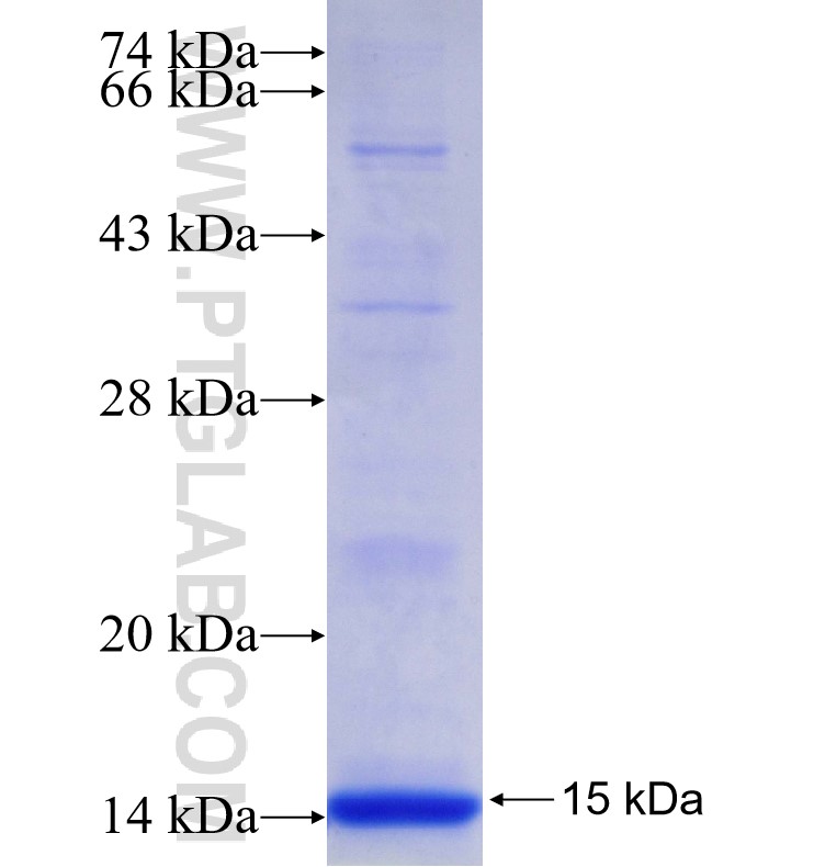 PABPC5 fusion protein Ag29439 SDS-PAGE PABPC5 fusion protein Ag29439 SDS-PAGE