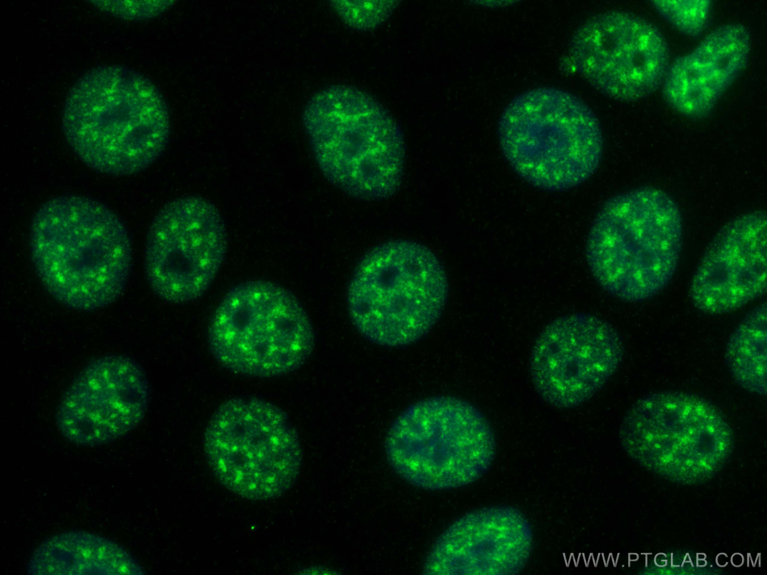 IF Staining of MCF-7 using 66807-1-Ig (same clone as 66807-1-PBS)