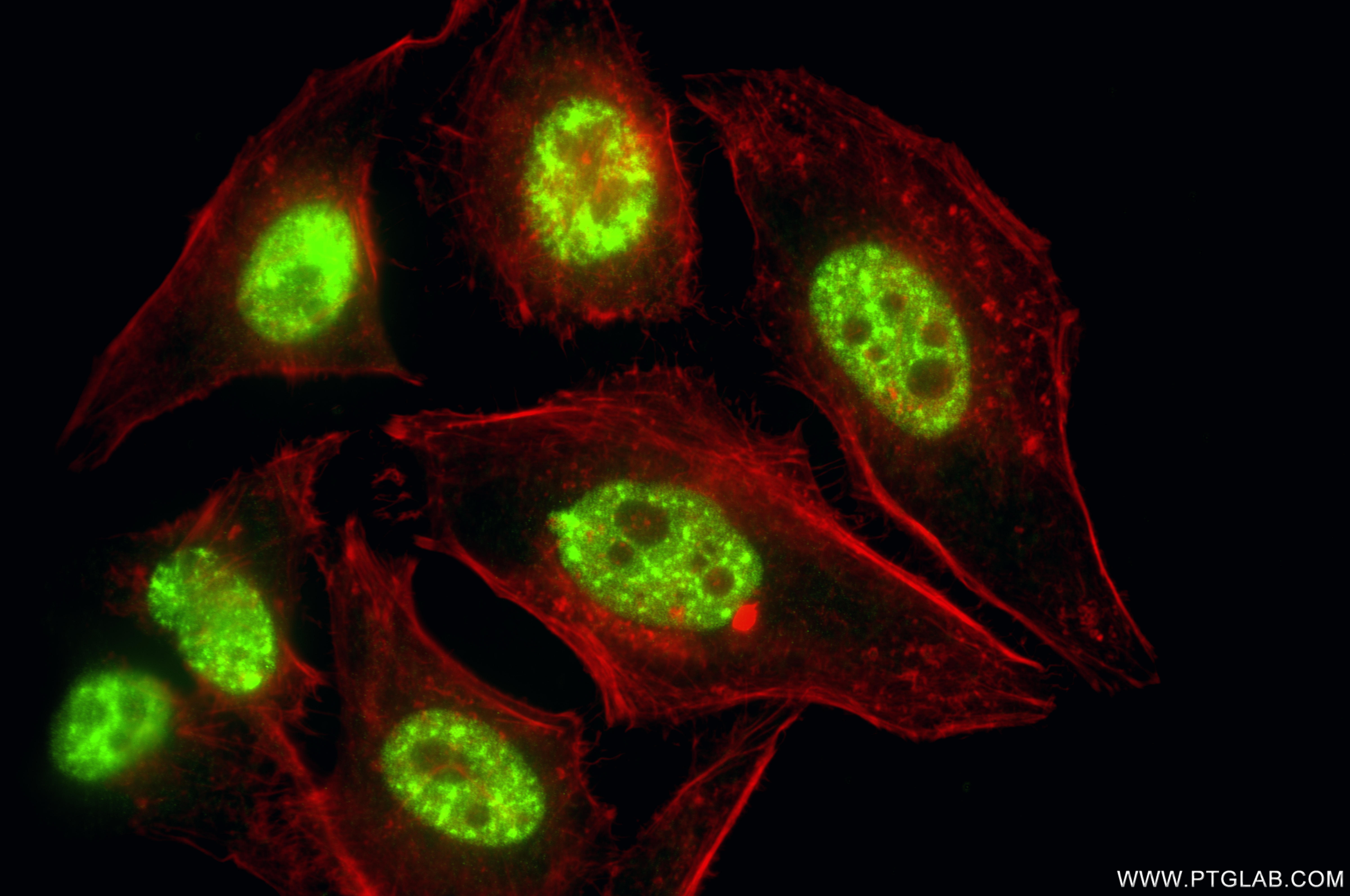 IF Staining of HeLa using 87392-1-RR IF Staining of HeLa using 87392-1-RR