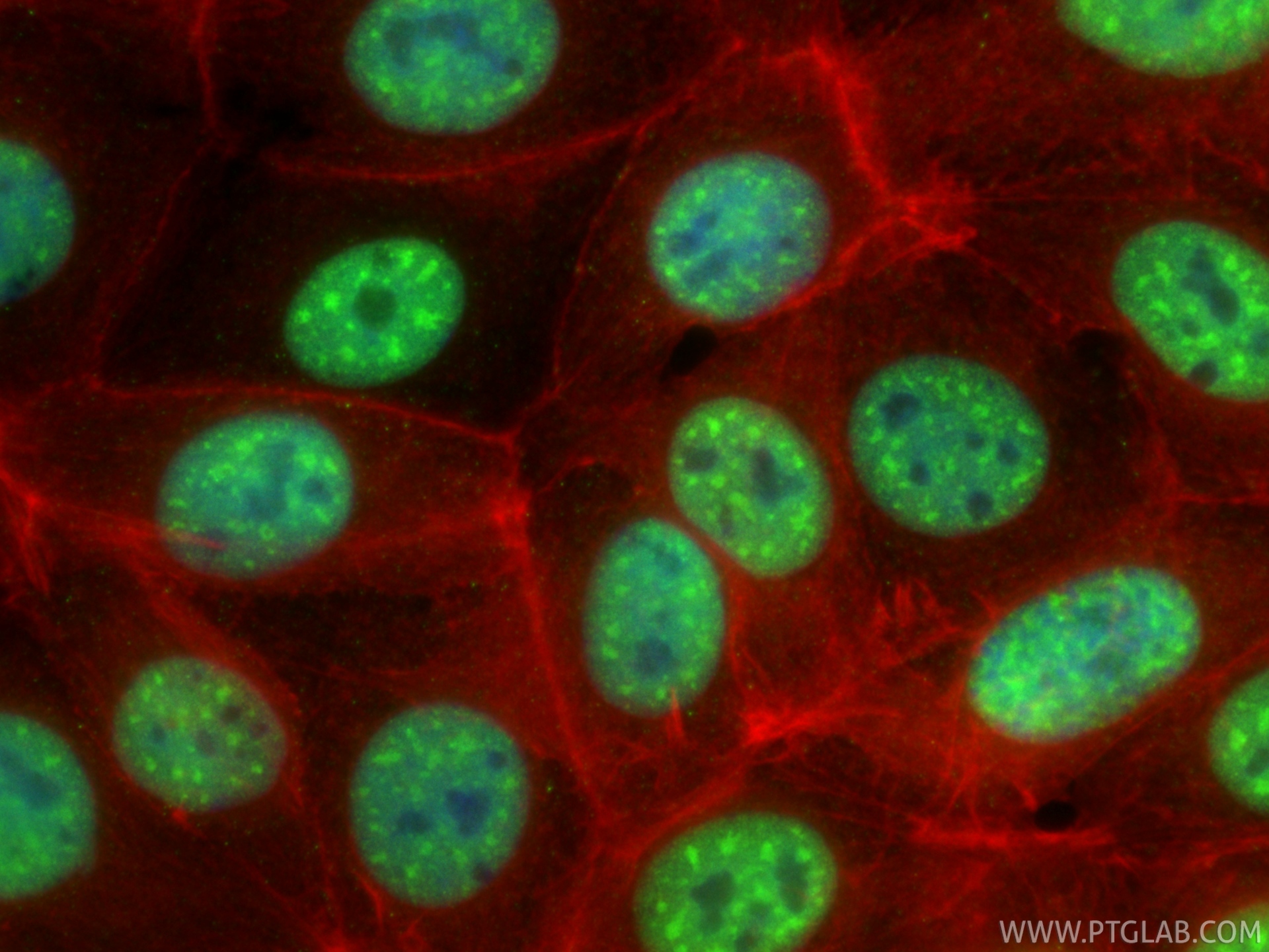 IF Staining of MCF-7 using 87392-1-RR IF Staining of MCF-7 using 87392-1-RR