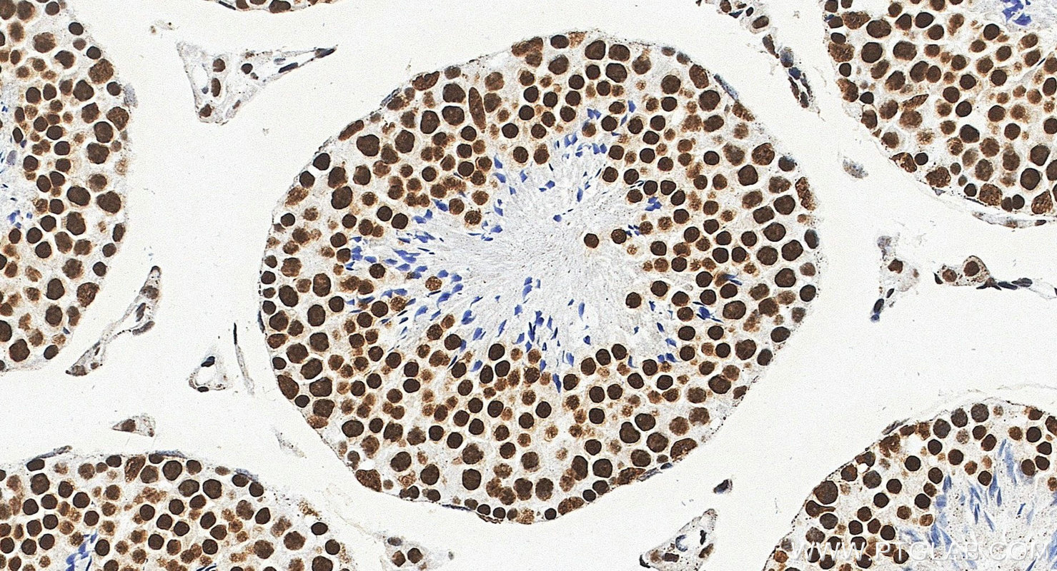 IHC staining of mouse testis using 87392-1-RR IHC staining of mouse testis using 87392-1-RR