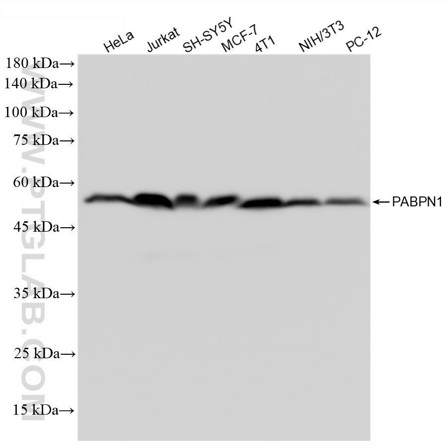 WB analysis using 87392-1-RR WB analysis using 87392-1-RR