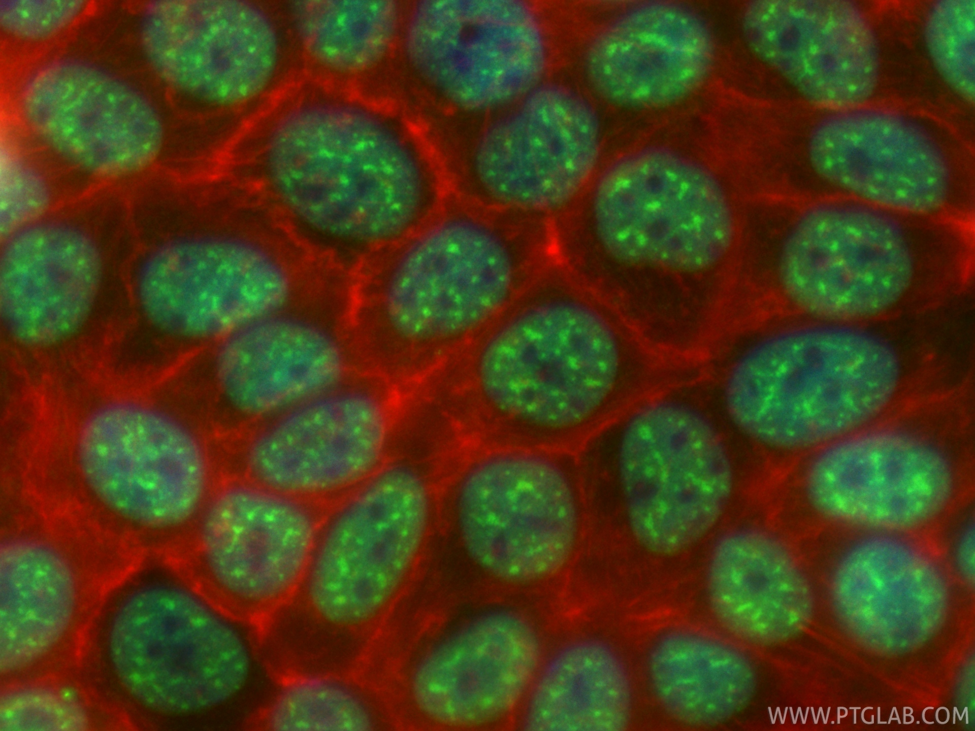 IF Staining of MCF-7 using CL488-87392 IF Staining of MCF-7 using CL488-87392