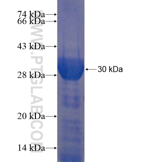 PACRGL fusion protein Ag22016 SDS-PAGE PACRGL fusion protein Ag22016 SDS-PAGE