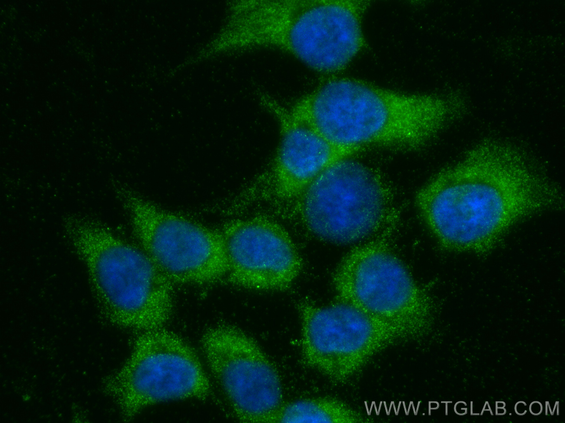 IF Staining of HCT 116 using 30172-1-AP