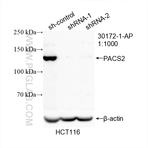 WB analysis of HCT 116 using 30172-1-AP