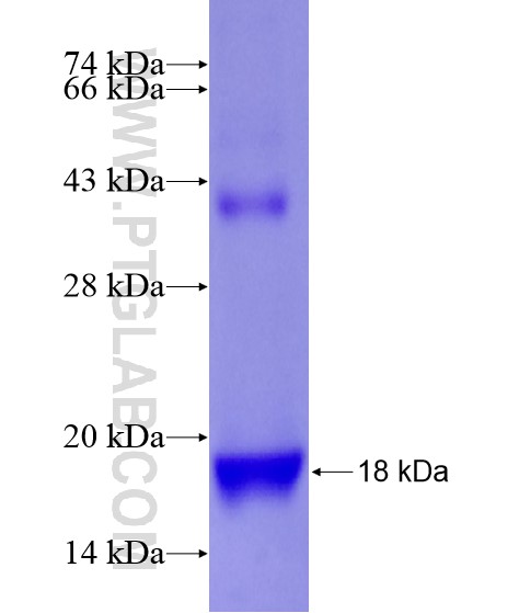 PADI1 fusion protein Ag21865 SDS-PAGE