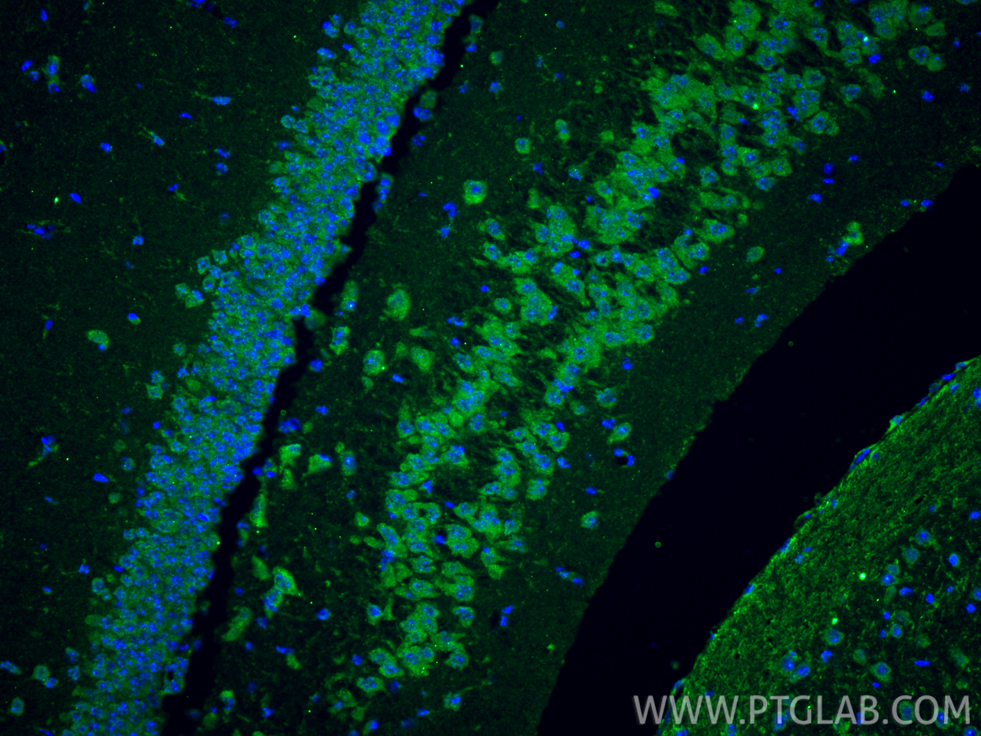 IF Staining of mouse brain using 12110-1-AP