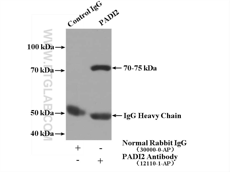 IP experiment of mouse brain using 12110-1-AP