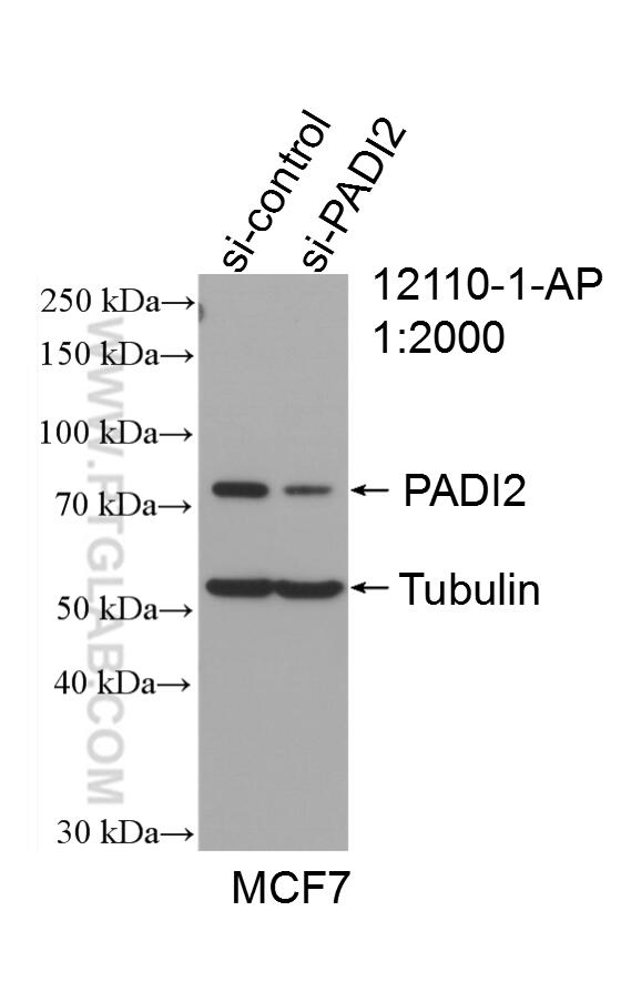 WB analysis of MCF-7 using 12110-1-AP