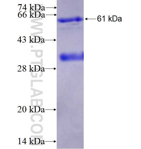 PADI2 fusion protein Ag2755 SDS-PAGE