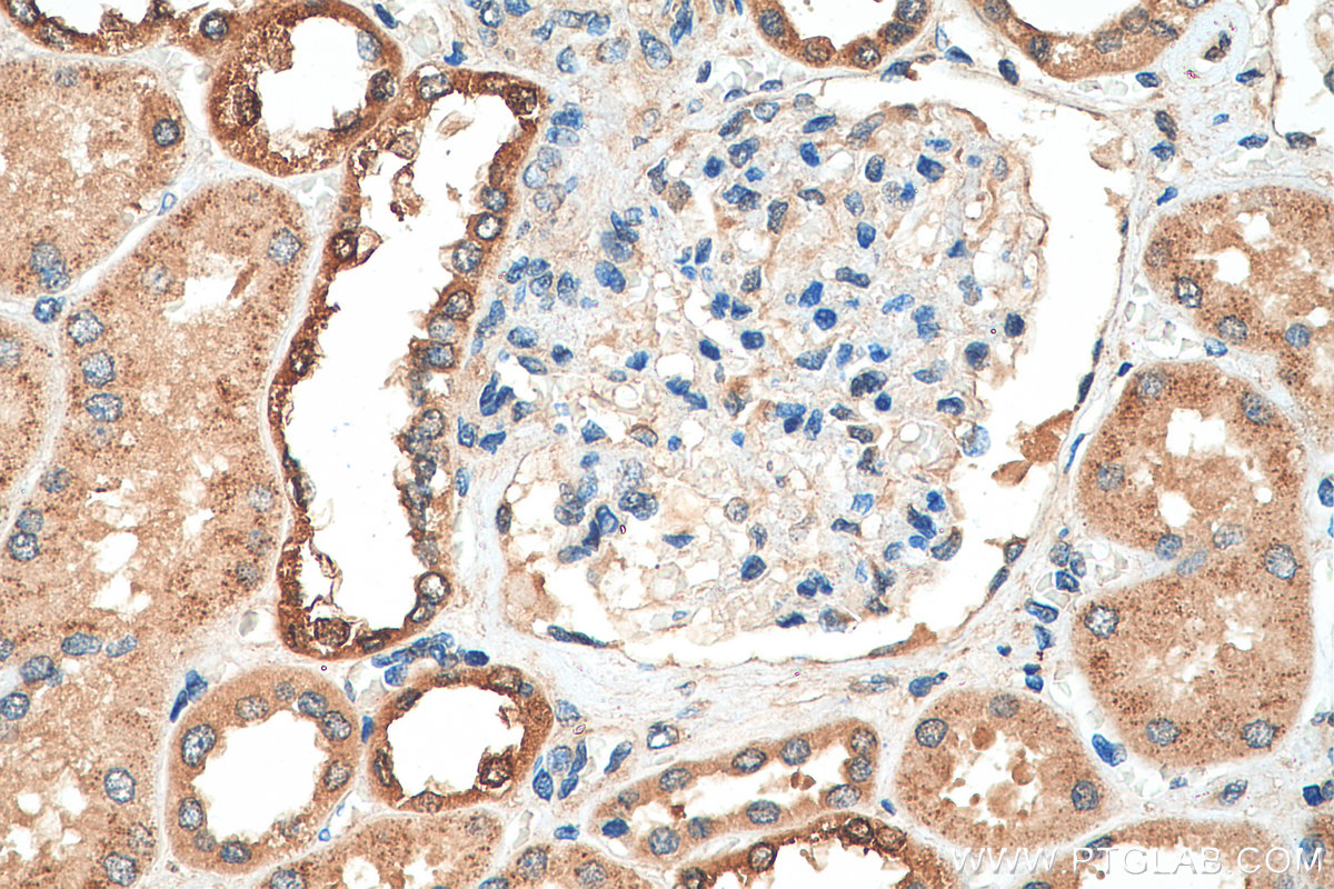 IHC staining of human kidney using 29169-1-AP