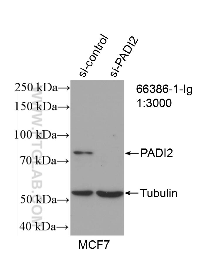 WB analysis of MCF-7 using 66386-1-Ig