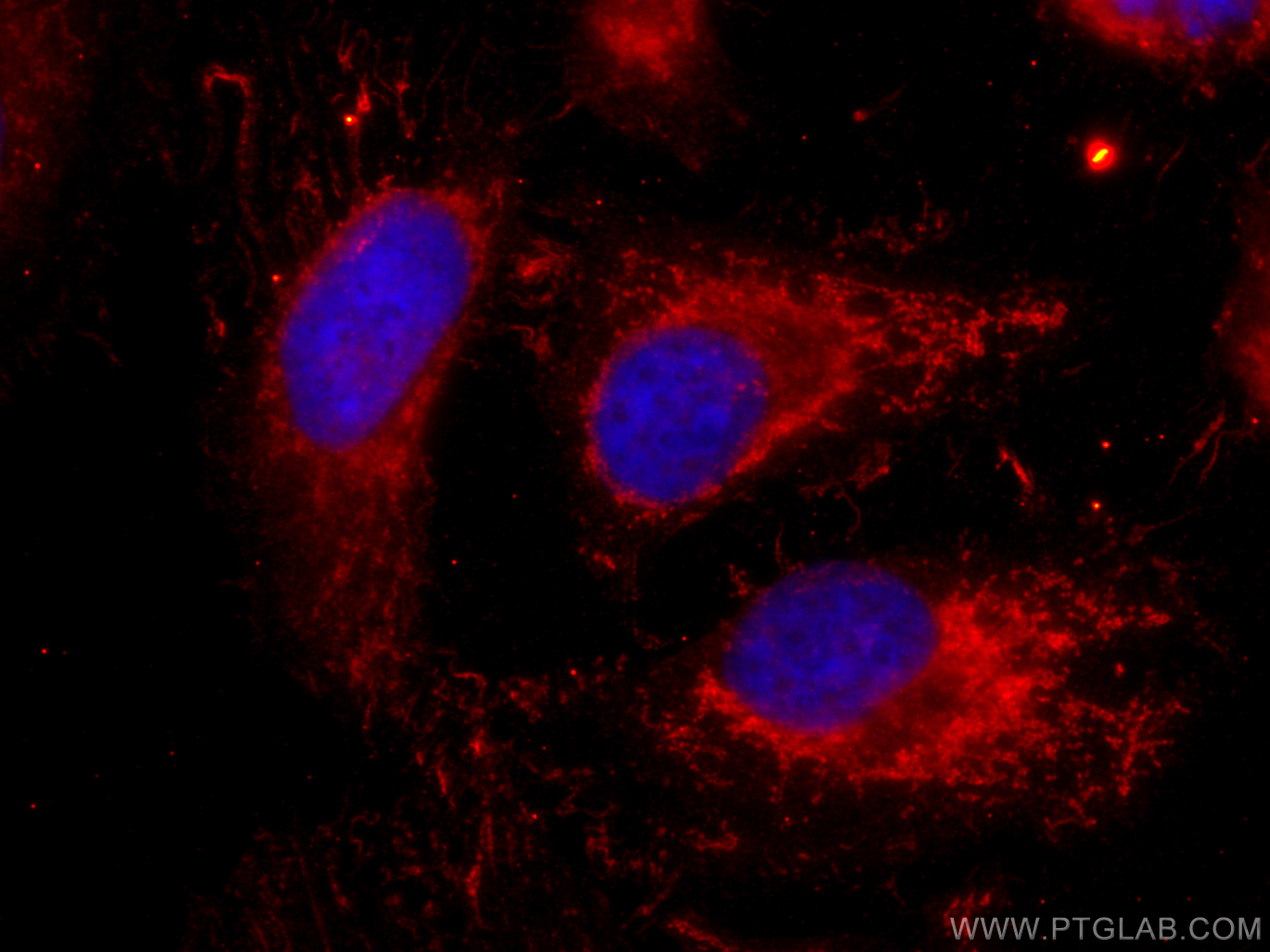 IF Staining of HeLa using CL594-66386