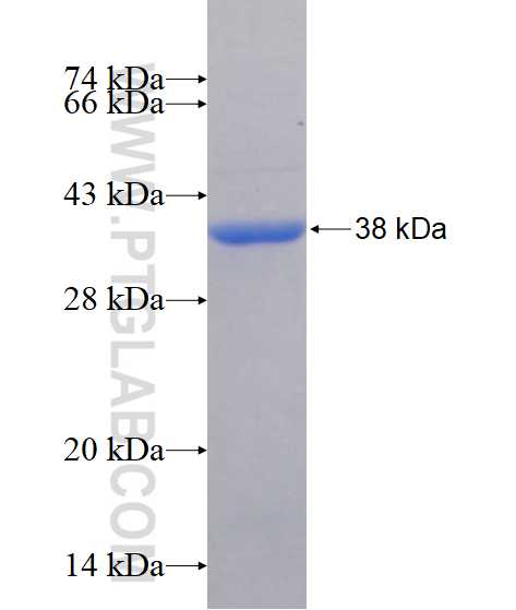 PADI2 fusion protein Ag17612 SDS-PAGE