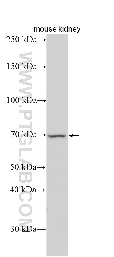WB analysis using 33848-1-AP (same clone as 33848-1-PBS)