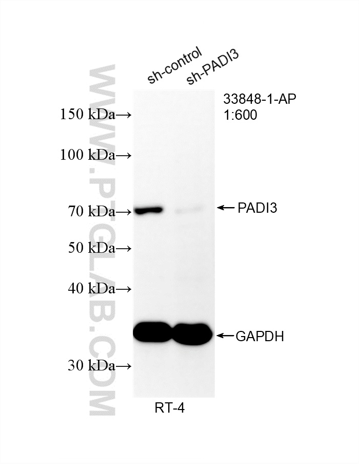 WB analysis of RT-4 using 33848-1-AP WB analysis of RT-4 using 33848-1-AP