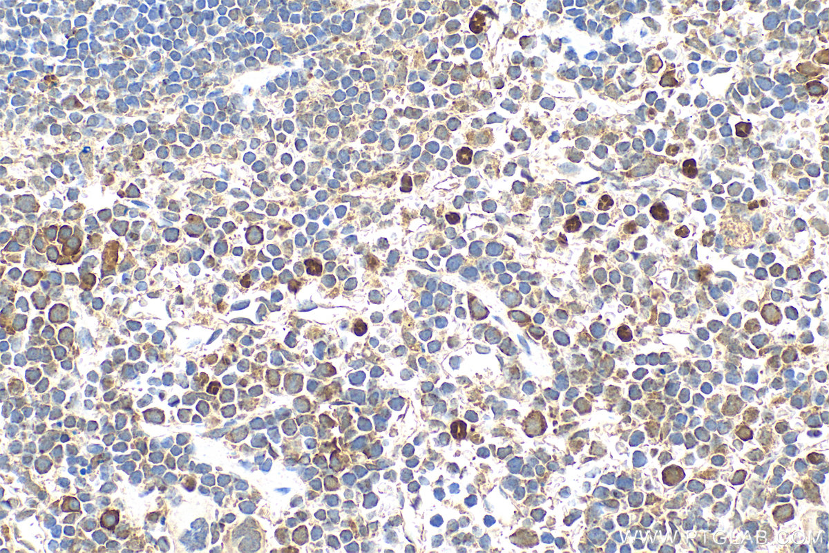 IHC staining of mouse spleen using 17373-1-AP