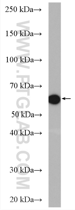 WB analysis of SKOV-3 using 17373-1-AP