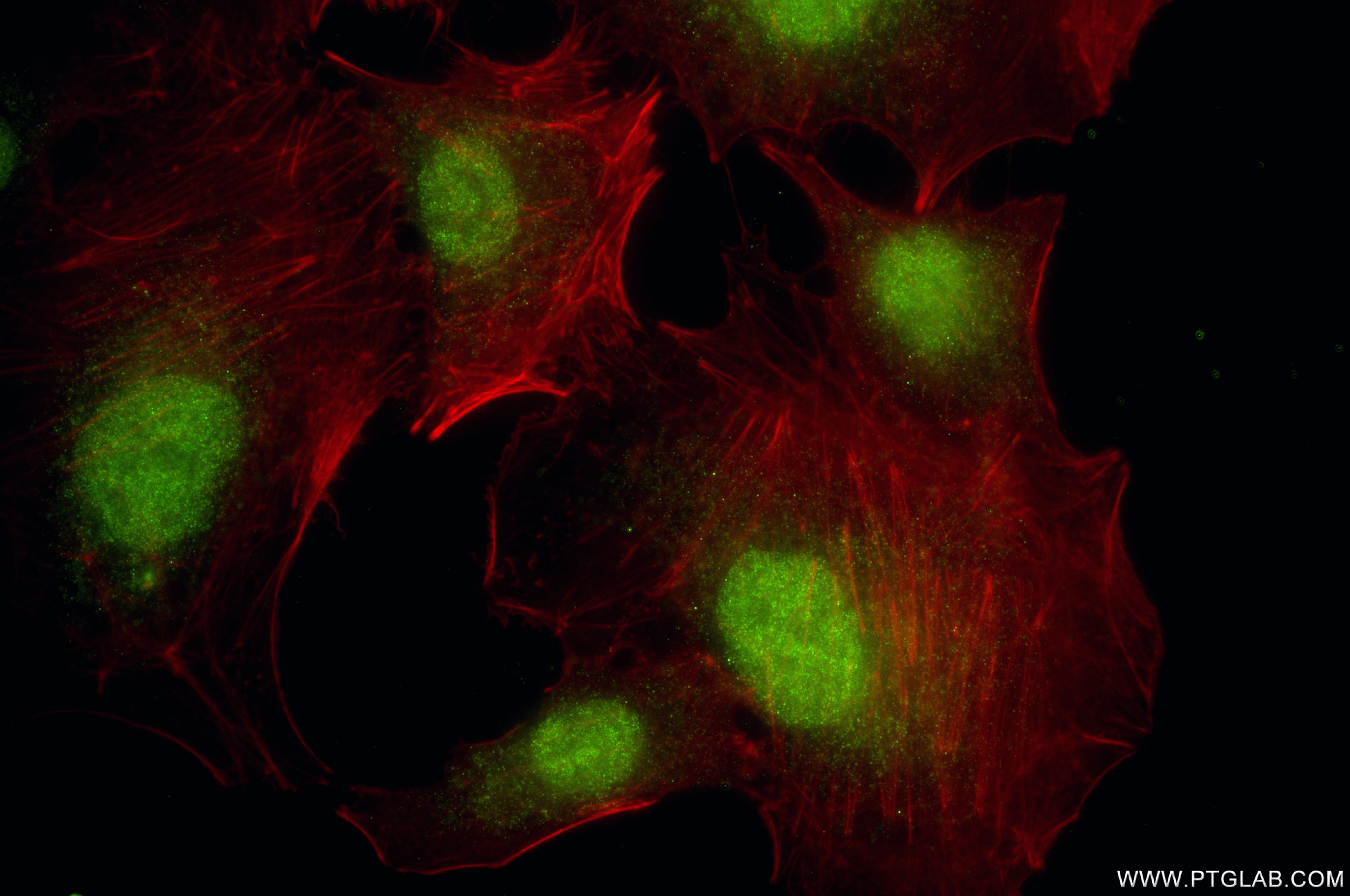 IF Staining of A549 using 86419-1-RR IF Staining of A549 using 86419-1-RR