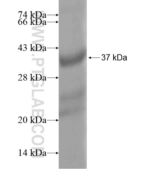 PADI6 fusion protein Ag20464 SDS-PAGE PADI6 fusion protein Ag20464 SDS-PAGE