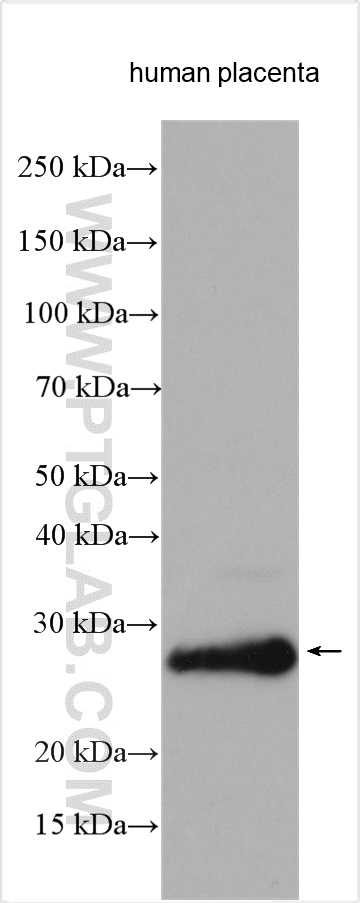 PAEP/Glycodelin