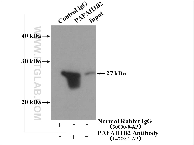 IP experiment of mouse testis using 14729-1-AP