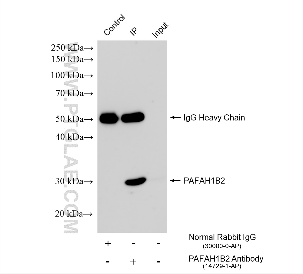 IP experiment of mouse small intestine using 14729-1-AP IP experiment of mouse small intestine using 14729-1-AP