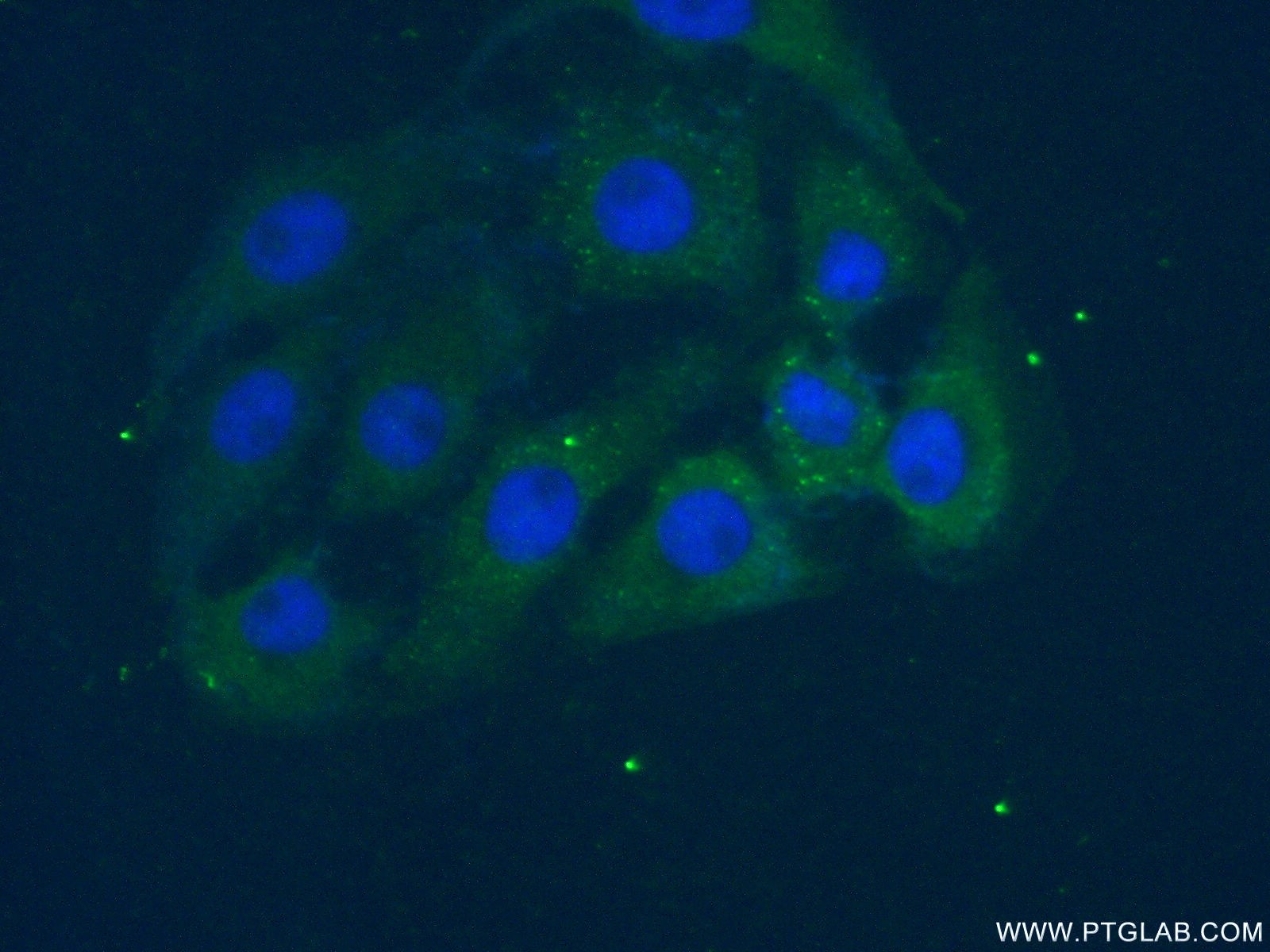 IF Staining of SH-SY5Y using 20564-1-AP