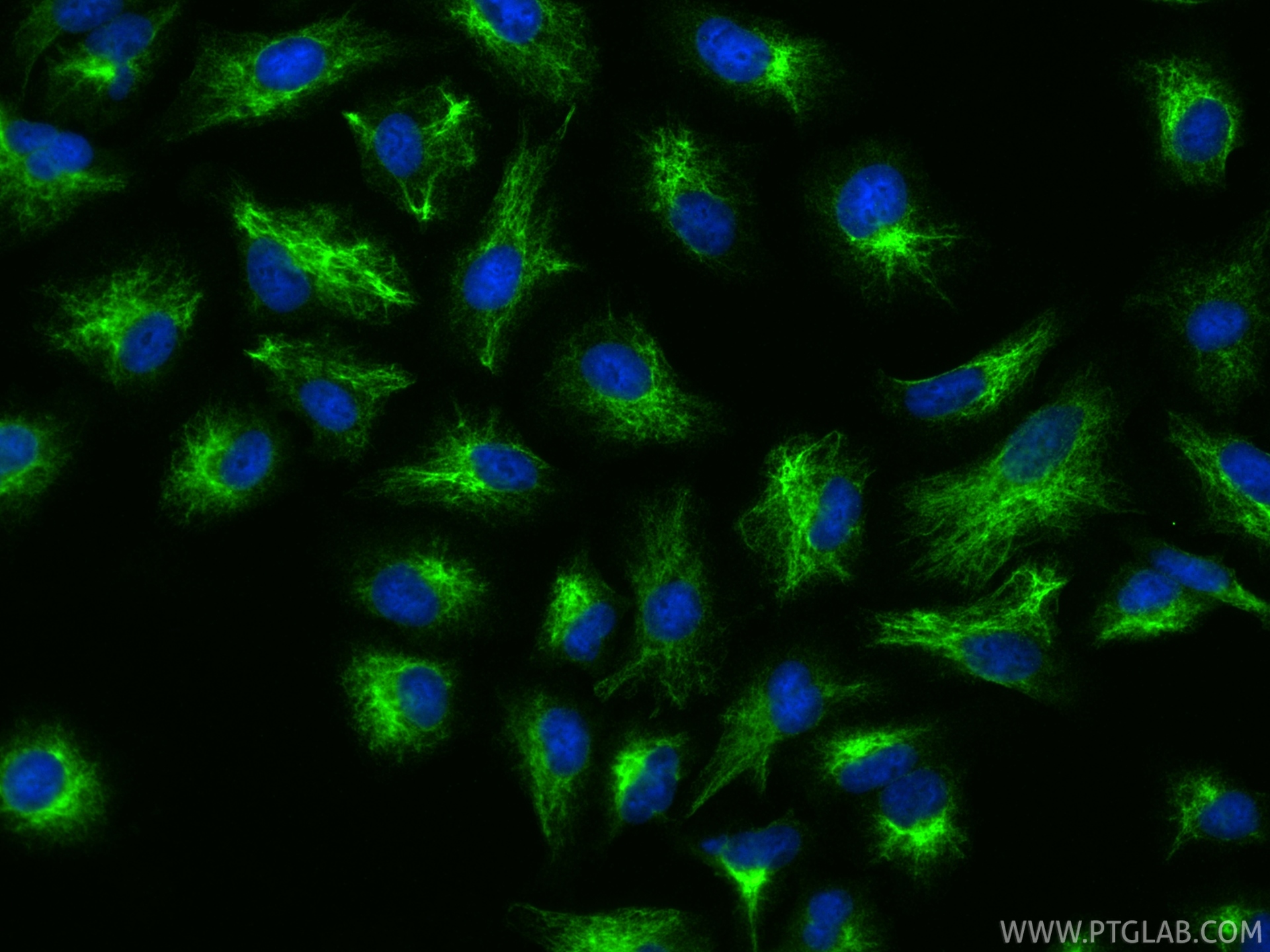 IF Staining of A549 using 20564-1-AP IF Staining of A549 using 20564-1-AP