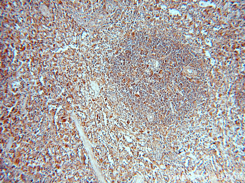 IHC staining of human spleen using 20564-1-AP