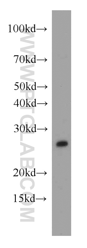 WB analysis of human brain using 20564-1-AP