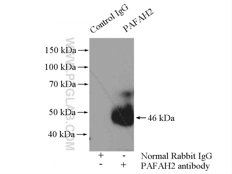 IP experiment of mouse liver using 10085-1-AP