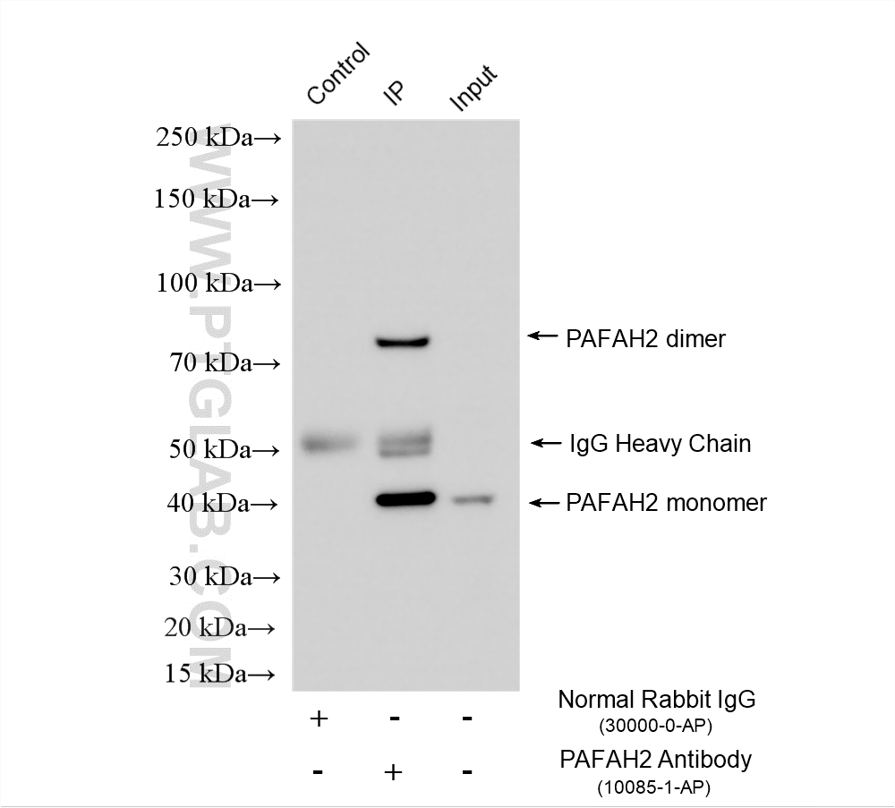 IP experiment of mouse testis using 10085-1-AP (same clone as 10085-1-PBS) IP experiment of mouse testis using 10085-1-AP (same clone as 10085-1-PBS)