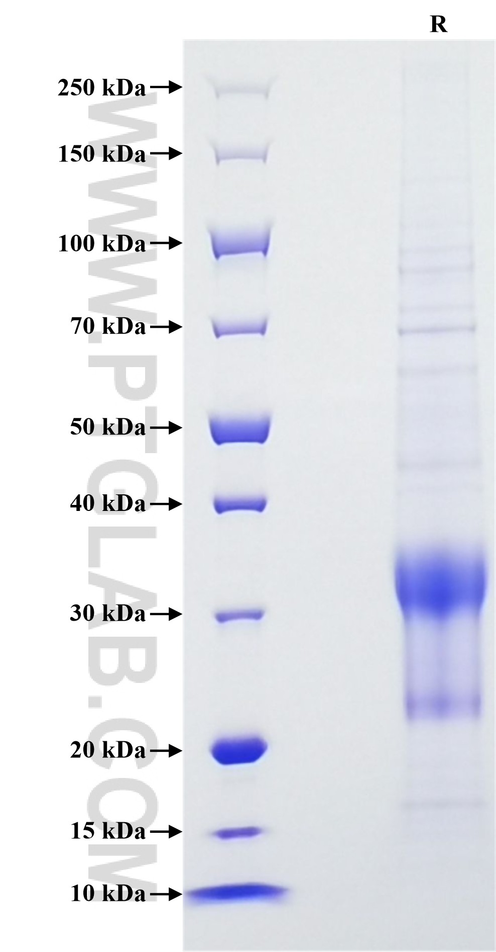 Purity of Recombinant Human CTLA-4 was determined by SDS-PAGE. The protein was resolved in an SDS-PAGE in reducing (R) conditions and stained using Coomassie blue.