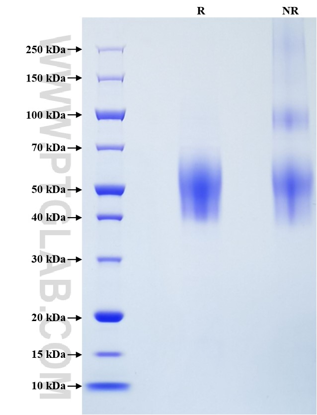 Purity of Recombinant Human CD226 was determined by SDS-PAGE. The protein was resolved in an SDS-PAGE in reducing (R) and non-reducing (NR) conditions and stained using Coomassie blue.
