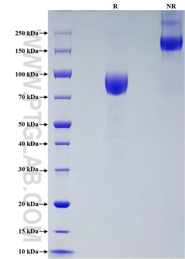 Purity of Recombinant Human CD200R1 was determined by SDS-PAGE. The protein was resolved in an SDS-PAGE in reducing (R) and non-reducing (NR) conditions and stained using Coomassie blue.