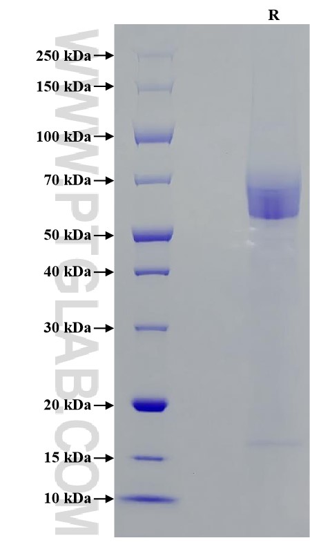 Purity of Recombinant Human CD27 was determined by SDS-PAGE. The protein was resolved in an SDS-PAGE in reducing (R) conditions and stained using Coomassie blue.