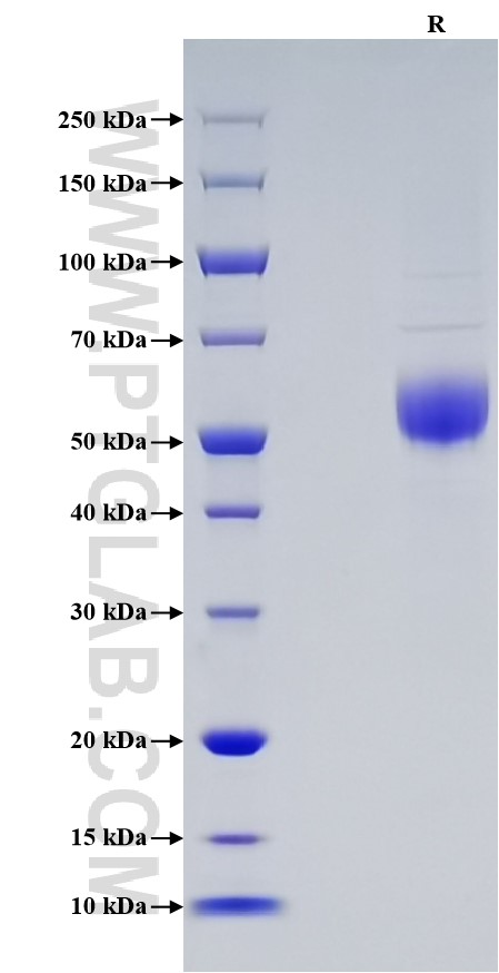 Purity of Recombinant Human ICOS was determined by SDS-PAGE. The protein was resolved in an SDS-PAGE in reducing (R) conditions and stained using Coomassie blue.