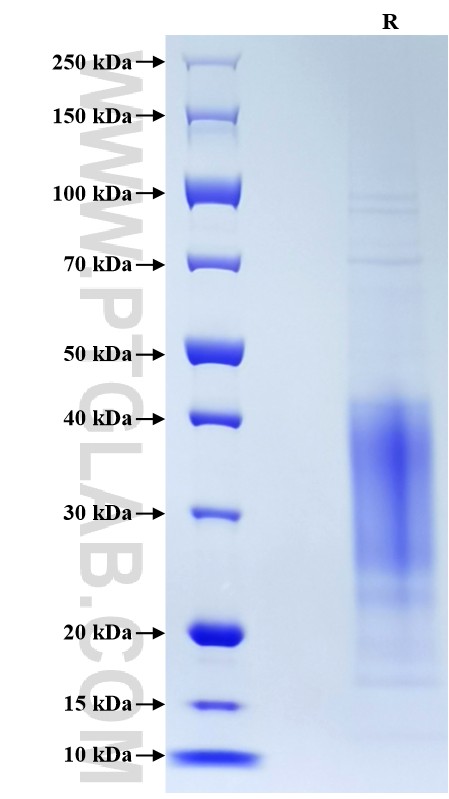 Purity of Recombinant Human IL-13 was determined by SDS-PAGE. The protein was resolved in an SDS-PAGE in reducing (R) conditions and stained using Coomassie blue. Purity of Recombinant Human IL-13 was determined by SDS-PAGE. The protein was resolved in an SDS-PAGE in reducing (R) conditions and stained using Coomassie blue.