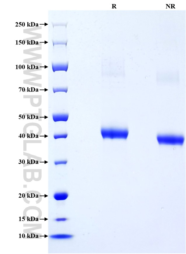 Purity of Recombinant Human CD209 was determined by SDS-PAGE. The protein was resolved in an SDS-PAGE in reducing (R) and non-reducing (NR) conditions and stained using Coomassie blue.