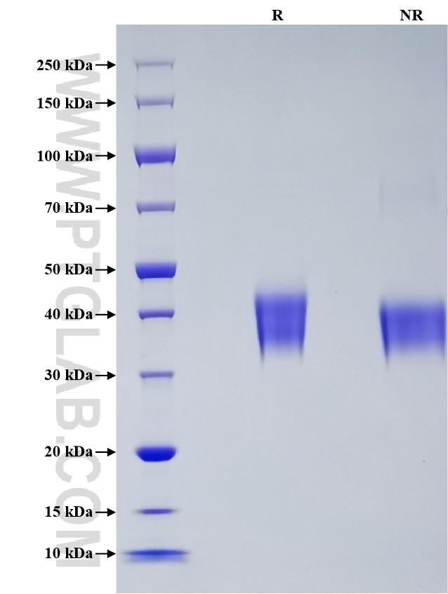 Purity of Recombinant SARS-CoV-2 Spike RBD was determined by SDS-PAGE. The protein was resolved in an SDS-PAGE in reducing (R) and non-reducing (NR) conditions and stained using Coomassie blue.