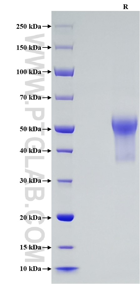 Purity of Recombinant Human TNFR2 was determined by SDS-PAGE. The protein was resolved in an SDS-PAGE in reducing (R) conditions and stained using Coomassie blue.