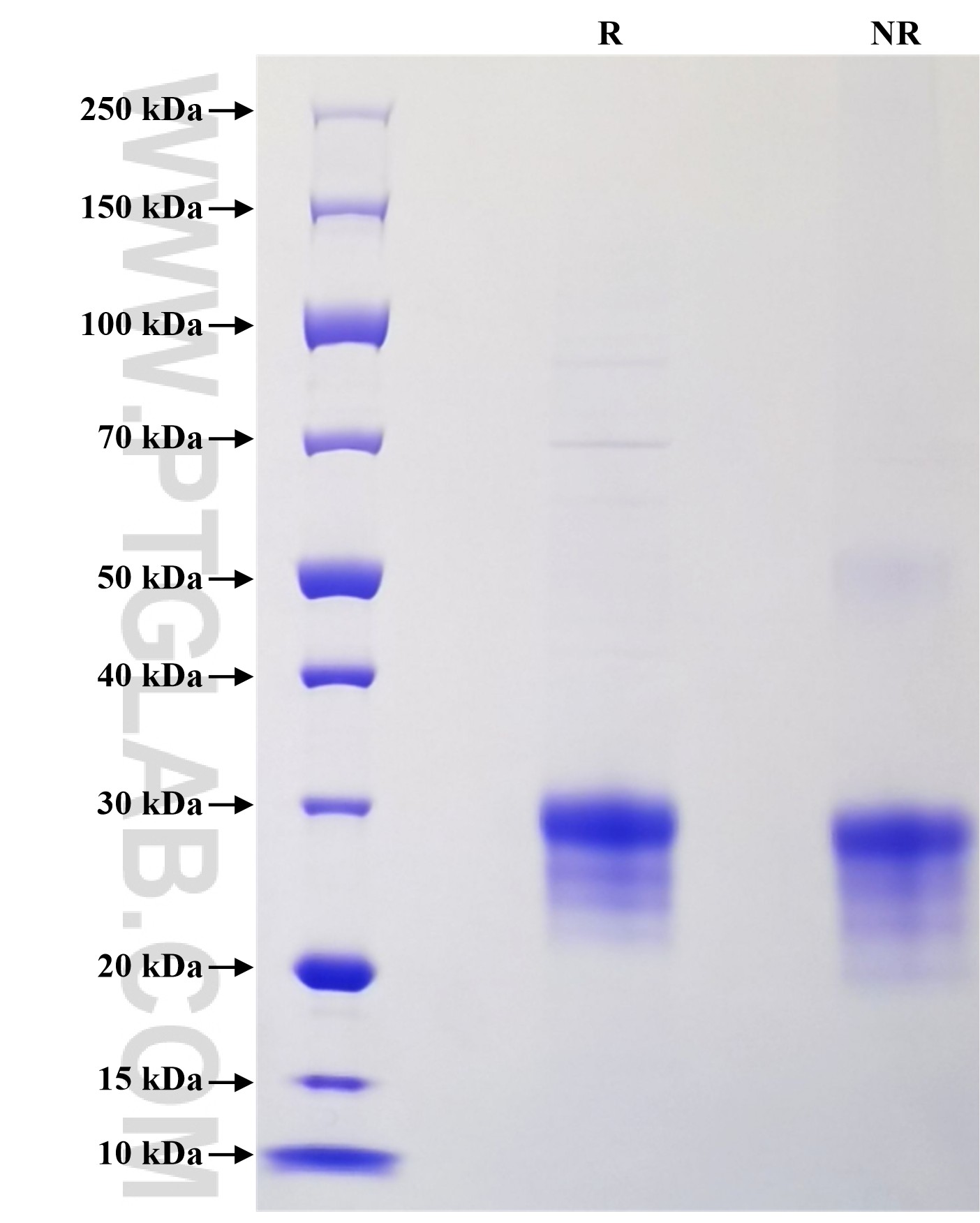 Purity of Recombinant Human IL-4 was determined by SDS-PAGE. The protein was resolved in an SDS-PAGE in reducing (R) and non-reducing (NR) conditions and stained using Coomassie blue.