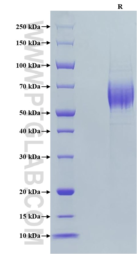 Purity of Recombinant Human ST2 was determined by SDS-PAGE. The protein was resolved in an SDS-PAGE in reducing (R) conditions and stained using Coomassie blue.