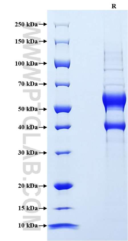 Purity of Recombinant Human VEGF-B was determined by SDS-PAGE. The protein was resolved in an SDS-PAGE in reducing (R) conditions and stained using Coomassie blue.